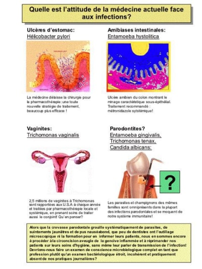 Paro lmnevi - Eugenol