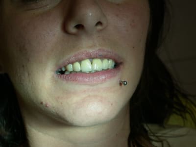 Pas3 asxrbu - Eugenol