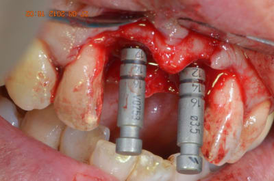 Passas 007 tpbvp7 - Eugenol