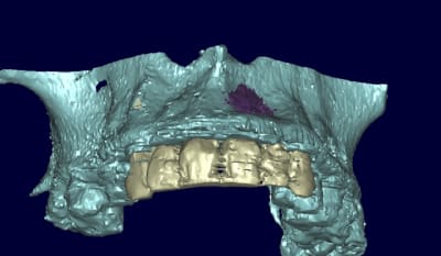 Patricia 3d fpt8mt - Eugenol