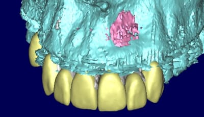 Patricia 3d rzjvtl - Eugenol