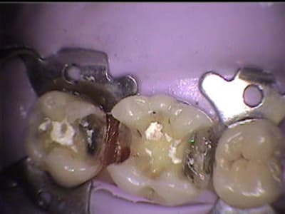 Pendant m8mpti - Eugenol
