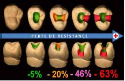 Perte r sistance mbmuve - Eugenol