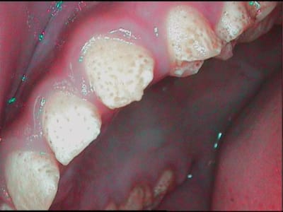 Petite2 ceplcl - Eugenol