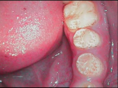 Petite 1 stxc9e - Eugenol
