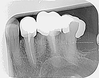 Phgoj9atfh7mtdfyot3c - Eugenol