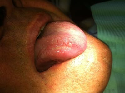 Photo 1  m5l8ex - Eugenol