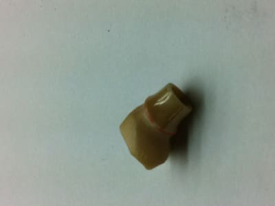 Photo 2 cwxiqr - Eugenol