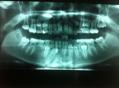Photo 2 tk7rrl - Eugenol