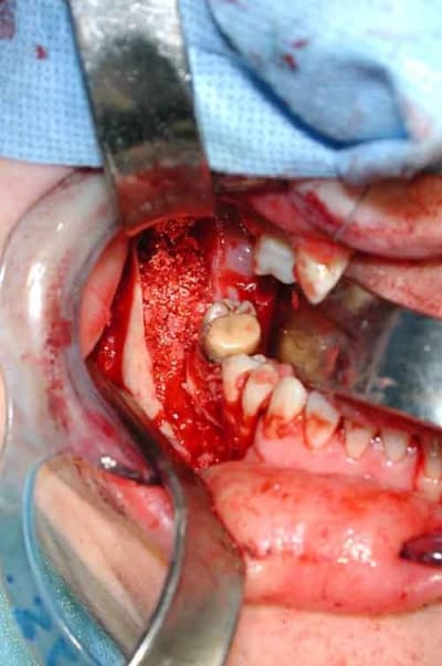 Photo 3 xcka2m - Eugenol