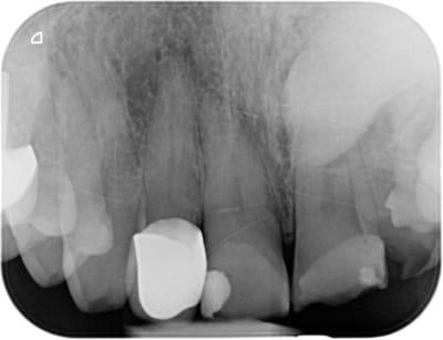 Photo 4 zcjaso - Eugenol