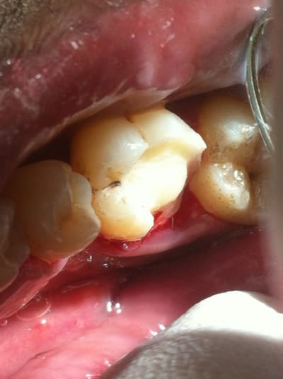 Photo 5 i84zir - Eugenol