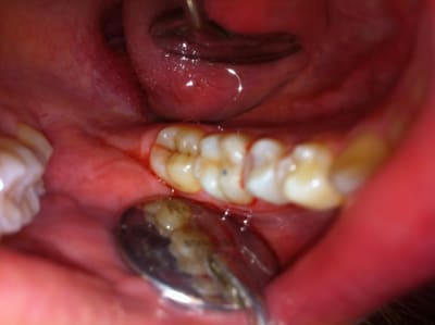 Photo h87pn5 - Eugenol