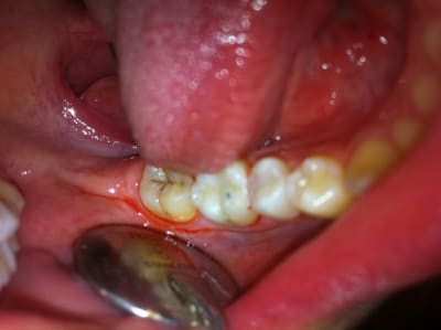 Photo kly2fa - Eugenol