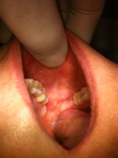 Photodlrieu uhyegw - Eugenol