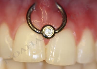 Piercing at4p7p - Eugenol