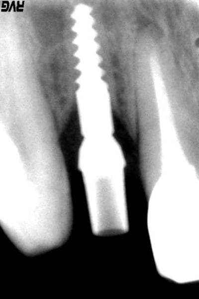Pilier 29 sep zopapq - Eugenol