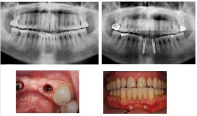 Planche 42 32 o8fsci - Eugenol