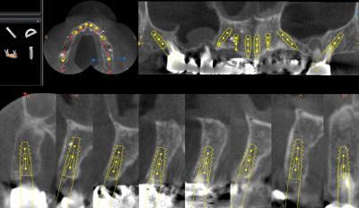 Planif aahwvm - Eugenol