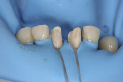 Pose2 wtki1k - Eugenol