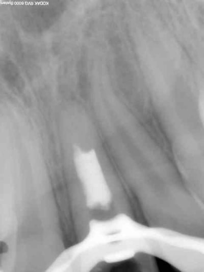 Post jopvpy - Eugenol