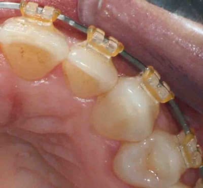 Pourjeris pj7bhv - Eugenol