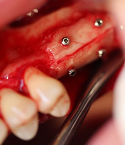 Pouy 023 ipayac - Eugenol