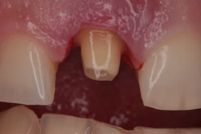Pr paration  2  rrawxy - Eugenol