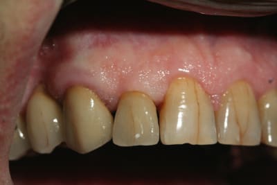 Prise de teinte rsi9k4 - Eugenol