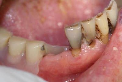 Proth se1 cq5gxi - Eugenol