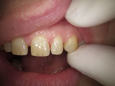 Pz4wrc7r2e3dpbis7tb5n2fhydc8 - Eugenol