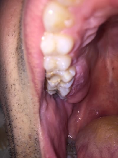 Q4puxawtowv8ktayfv7b - Eugenol