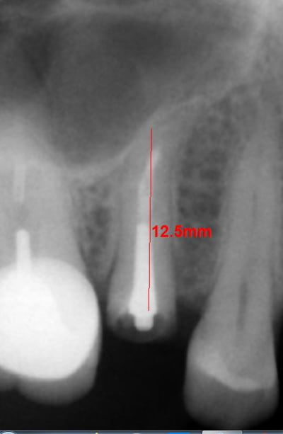 Q4sna9jlxqdhb9rllokf - Eugenol