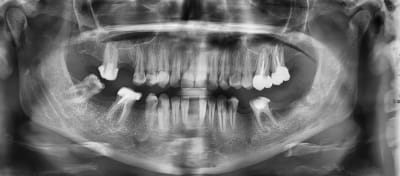 Qqbmumtmrn2gmu1k0cbs - Eugenol