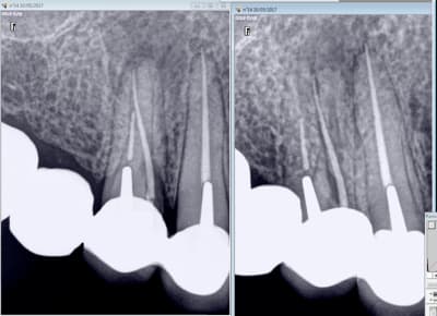 Qryoh7hg3enywi5pwakd - Eugenol