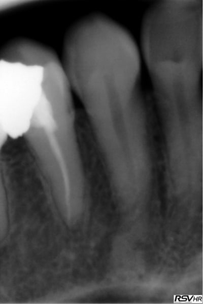 Quesaco uxhxaf - Eugenol