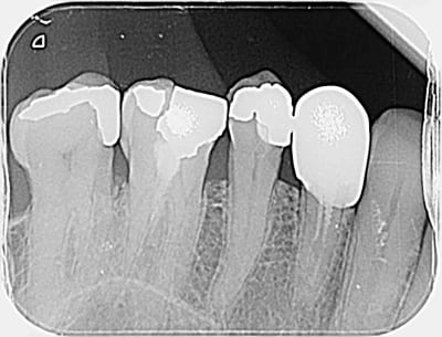 Quxchg3olm4wleczilpm - Eugenol