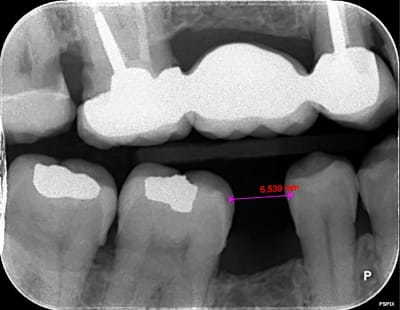 Qy7ig3eakeknmjl1oksj - Eugenol