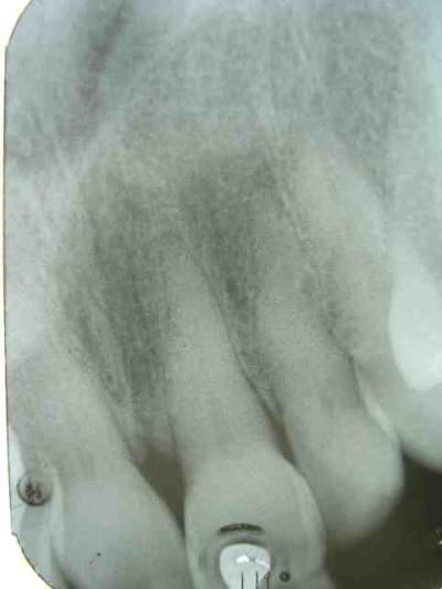 Rétro csz8mj - Eugenol