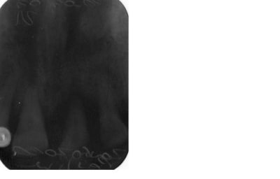 Rétro gxzh6t - Eugenol