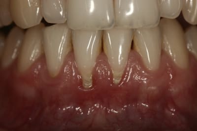 R cesions2 ddxyj2 - Eugenol