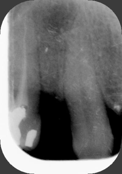 Radio13 pvtbpx - Eugenol