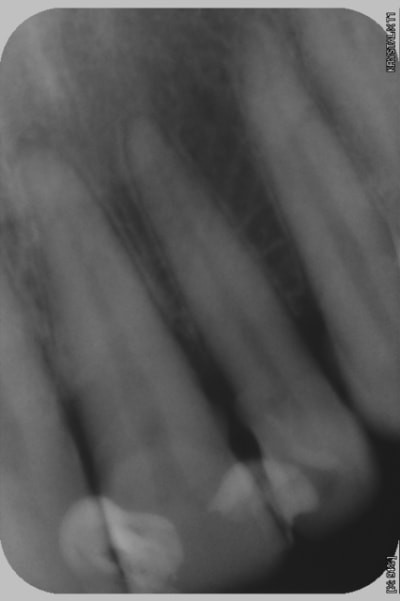 Radio1 xutot5 - Eugenol