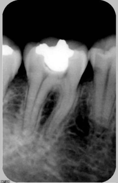 Radio46 ntlzxe - Eugenol