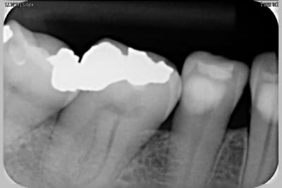 Radio 46 2009 eomewu - Eugenol