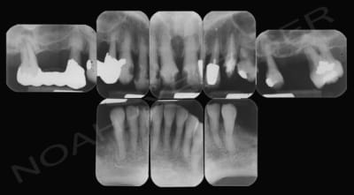 Radio initiales dq0rlp - Eugenol