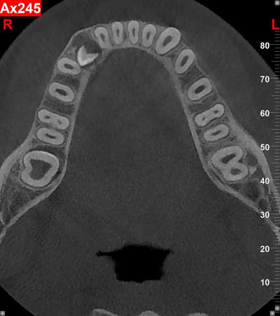 Rc0qlopxuhdqtiwzrtpb0477707x - Eugenol