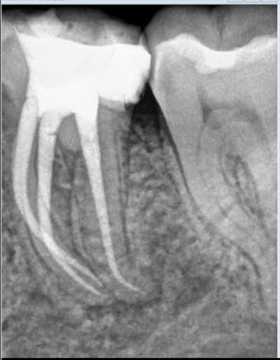 Rdueoo3g4bebnvfk01pkmbwhbpm4 - Eugenol