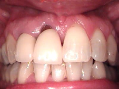 Recession2 jgwuer - Eugenol