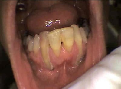 Recession  ktsugr - Eugenol